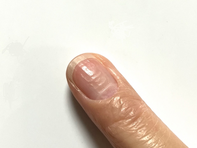 爪のでこぼこが気になる！でこぼこ爪の原因と対策