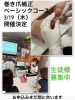 巻き爪補正ベーシックコース – 巻き爪ケア・ヨネクラ｜千葉市稲毛区